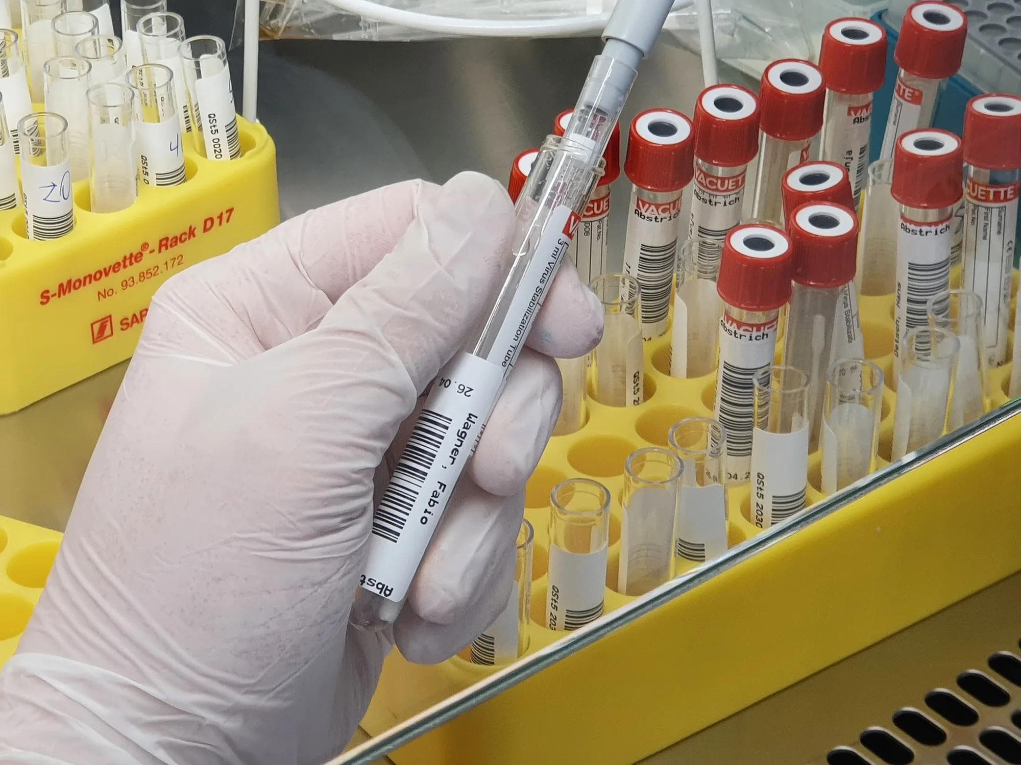 Der Abstrich von Fabio Wagner wird für einen PCR-Test vorbereitet.